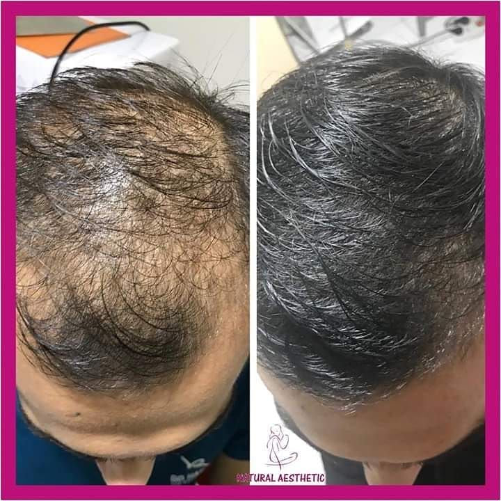 GARUDDA RABBIT HERBAL HAIR OIL